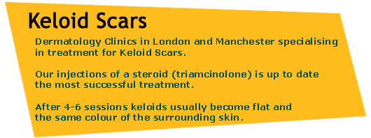 Keloid Scars