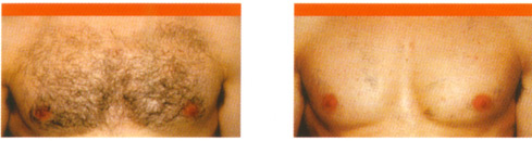 before and after treatment