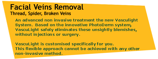 Veins Removal - Thread, Spider, Facial, Broken Veins